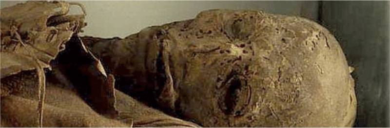 Guanche-mummie op Tenerife, detail van het bewaarde gezicht.